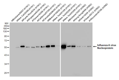 Anti-Influenza A virus Nucleoprotein antibody [HL1089] used in Western Blot (WB). GTX636247