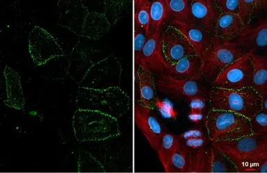 Anti-ACE2 antibody [HL1092] used in Immunocytochemistry/ Immunofluorescence (ICC/IF). GTX636265