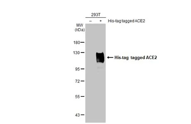 Anti-ACE2 antibody [HL1092] used in Western Blot (WB). GTX636265