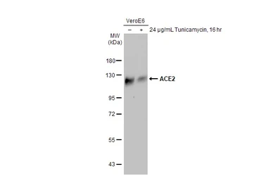 Anti-ACE2 antibody [HL1092] used in Western Blot (WB). GTX636265