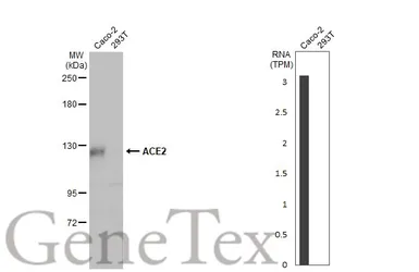 Anti-ACE2 antibody [HL1092] used in Western Blot (WB). GTX636265