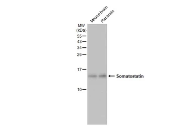 Anti-Somatostatin antibody [HL1101] used in Western Blot (WB). GTX636297