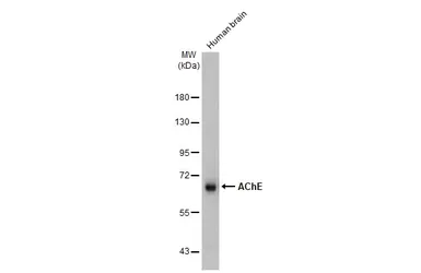 Anti-AChE antibody [HL1102] used in Western Blot (WB). GTX636298