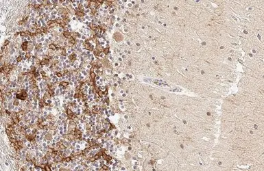 Anti-AChE antibody [HL1102] used in IHC (Paraffin sections) (IHC-P). GTX636298