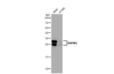 Anti-RBPMS antibody [HL1105] used in Western Blot (WB). GTX636320