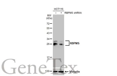 Anti-RBPMS antibody [HL1105] used in Western Blot (WB). GTX636320