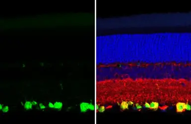 Anti-RBPMS antibody [HL1105] used in IHC (Paraffin sections) (IHC-P). GTX636320