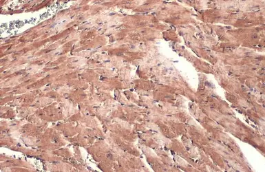 Anti-DDR2 antibody [HL1107] used in IHC (Paraffin sections) (IHC-P). GTX636322