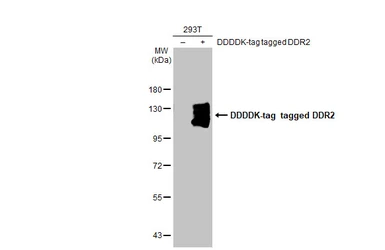 Anti-DDR2 antibody [HL1107] used in Western Blot (WB). GTX636322