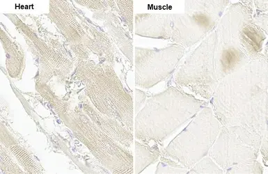 Anti-DDR2 antibody [HL1107] used in IHC (Paraffin sections) (IHC-P). GTX636322