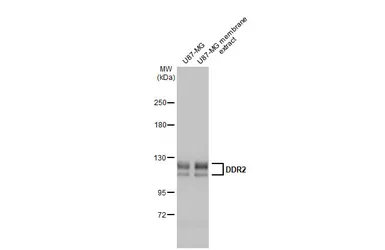 Anti-DDR2 antibody [HL1107] used in Western Blot (WB). GTX636322