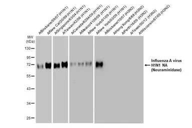 Anti-Influenza A virus H1N1 NA (Neuraminidase) antibody [HL1108] used in Western Blot (WB). GTX636323