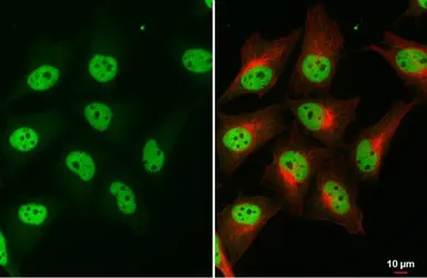 Anti-SMARCA2 antibody [HL1115] used in Immunocytochemistry/ Immunofluorescence (ICC/IF). GTX636330