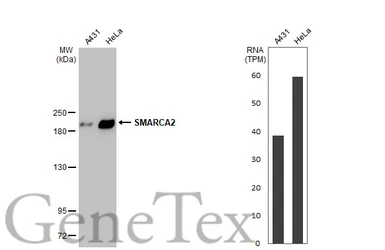 Anti-SMARCA2 antibody [HL1115] used in Western Blot (WB). GTX636330