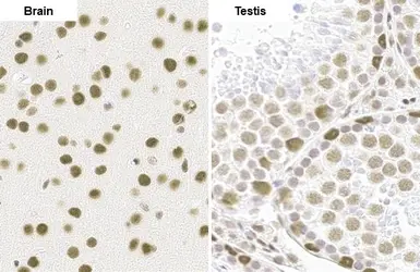 Anti-SMARCA2 antibody [HL1115] used in IHC (Paraffin sections) (IHC-P). GTX636330