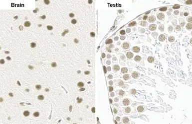 Anti-SMARCA2 antibody [HL1115] used in IHC (Paraffin sections) (IHC-P). GTX636330