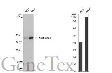 Anti-SMARCA2 antibody [HL1115] used in Western Blot (WB). GTX636330