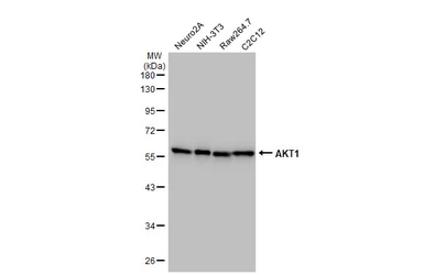 Anti-AKT1 antibody [HL1145] used in Western Blot (WB). GTX636416