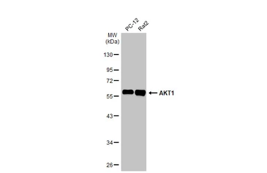 Anti-AKT1 antibody [HL1145] used in Western Blot (WB). GTX636416