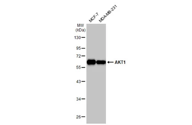 Anti-AKT1 antibody [HL1145] used in Western Blot (WB). GTX636416