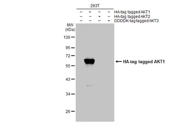 Anti-AKT1 antibody [HL1145] used in Western Blot (WB). GTX636416