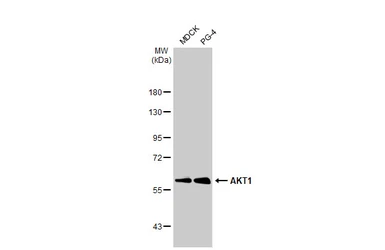 Anti-AKT1 antibody [HL1145] used in Western Blot (WB). GTX636416