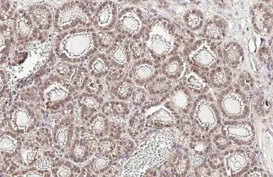 Anti-AKT1 antibody [HL1145] used in IHC (Paraffin sections) (IHC-P). GTX636416