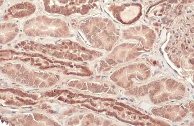 Anti-CPT1A antibody [HL1164] used in IHC (Paraffin sections) (IHC-P). GTX636468