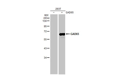 Anti-GAD65 + GAD67 antibody [HL1181] used in Western Blot (WB). GTX636487