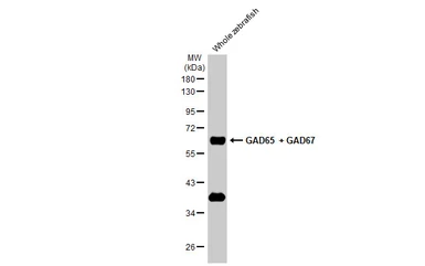 Anti-GAD65 + GAD67 antibody [HL1181] used in Western Blot (WB). GTX636487