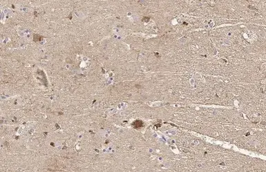 Anti-GAD65 + GAD67 antibody [HL1181] used in IHC (Paraffin sections) (IHC-P). GTX636487