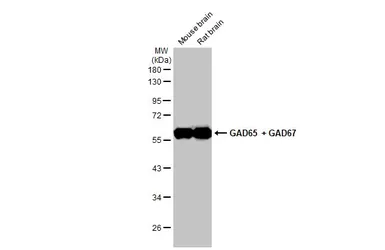 Anti-GAD65 + GAD67 antibody [HL1181] used in Western Blot (WB). GTX636487