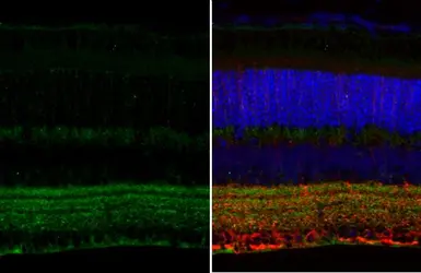 Anti-GAD65 + GAD67 antibody [HL1181] used in IHC (Paraffin sections) (IHC-P). GTX636487