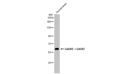 Anti-GAD65 + GAD67 antibody [HL1181] used in Western Blot (WB). GTX636487