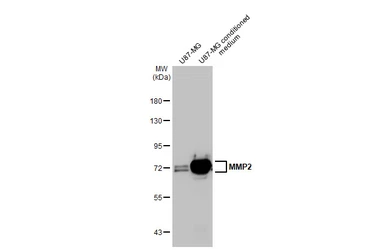 Anti-MMP2 antibody [HL1207] used in Western Blot (WB). GTX636524