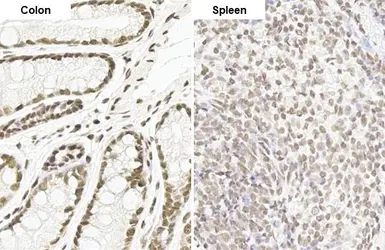 Anti-MMP2 antibody [HL1207] used in IHC (Paraffin sections) (IHC-P). GTX636524