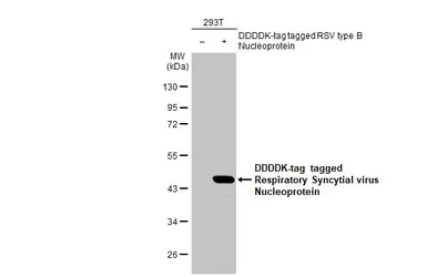 Anti-Respiratory Syncytial virus Nucleoprotein antibody [HL1245] used in Western Blot (WB). GTX636647