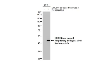 Anti-Respiratory Syncytial virus Nucleoprotein antibody [HL1245] used in Western Blot (WB). GTX636647