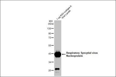 Anti-Respiratory Syncytial virus Nucleoprotein antibody [HL1246] used in Western Blot (WB). GTX636648