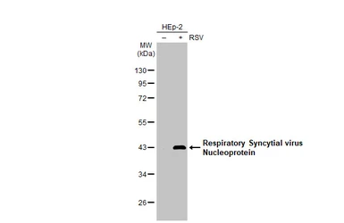 Anti-Respiratory Syncytial virus Nucleoprotein antibody [HL1246] used in Western Blot (WB). GTX636648