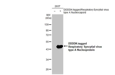 Anti-Respiratory Syncytial virus Nucleoprotein antibody [HL1246] used in Western Blot (WB). GTX636648