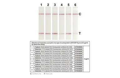 Anti-Respiratory Syncytial virus Nucleoprotein antibody [HL1246] used in Lateral Flow (Lateral Flow). GTX636648