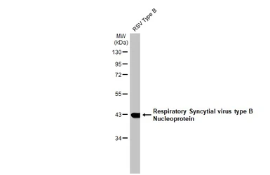 Anti-Respiratory Syncytial virus Nucleoprotein antibody [HL1247] used in Western Blot (WB). GTX636649