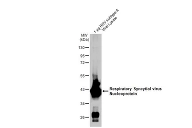 Anti-Respiratory Syncytial virus Nucleoprotein antibody [HL1247] used in Western Blot (WB). GTX636649