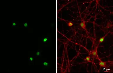 Anti-NFIX antibody [HL1269] used in Immunocytochemistry/ Immunofluorescence (ICC/IF). GTX636671