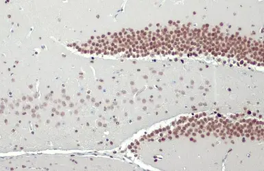 Anti-NFIX antibody [HL1269] used in IHC (Paraffin sections) (IHC-P). GTX636671