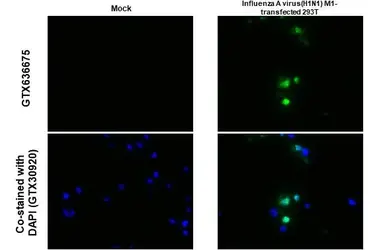 Anti-Influenza A virus M1 (matrix protein) antibody [HL1273] used in IHC-P (cell pellet) (IHC-P (cell pellet)). GTX636675