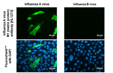 Anti-Influenza A virus M1 (matrix protein) antibody [HL1273] used in Immunocytochemistry/ Immunofluorescence (ICC/IF). GTX636675