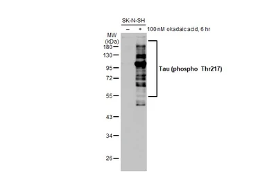 Anti-Tau (phospho Thr217) antibody [HL1276] used in Western Blot (WB). GTX636678