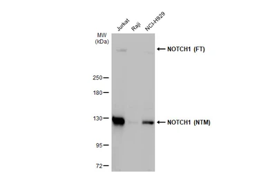 Anti-NOTCH1 antibody [HL1281] used in Western Blot (WB). GTX636683